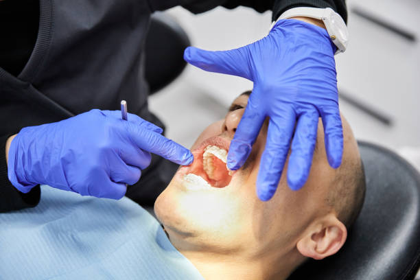 Best Emergency Wisdom Tooth Extraction in High Springs, FL