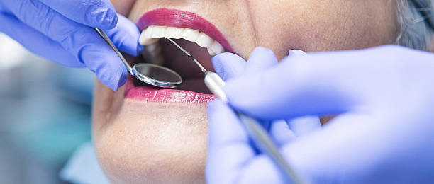 Best Emergency Cosmetic Dentistry (e.g., broken veneers) in High Springs, FL